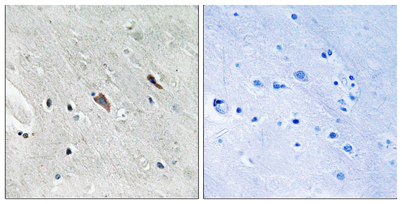 Immunohistochemistry analysis of paraffin-embedded human brain, using Gab2 (Phospho-Tyr643) Antibody. The picture on the right is blocked with the phospho peptide.