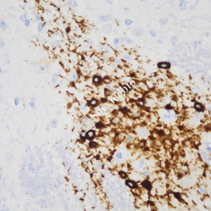 Immunohistochemistry analysis of paraffin embedded mouse Brain using Tyrosine Hydroxylase at dilution of 1: 1000