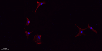 Immunofluorescence analysis of A549. 1,primary Antibody (red) was diluted at 1:200 (4°C overnight). 2, Goat Anti Rabbit IgG (H&L) - Alexa Fluor 594 Secondary antibody was diluted at 1:1000 (room temperature, 50min).3, Picture B: DAPI (blue) 10min.