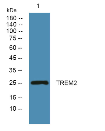 Western blot analysis of lysates from DU145 cells, primary antibody was diluted at 1:1000, 4°over night
