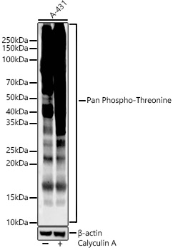 Western blot analysis of lysates from A-431, using Pan Phospho-Threonine Rabbit mAb (AP1422) at 1:1000 dilution. A 431 treated by Calyculin A (100 nM) at 37℃ for 30 minutes after serum-starvation overnight.
Secondary antibody: HRP-conjugated Goat anti-Rabbit IgG (H+L) (AS014) at 1:10000 dilution.
Lysates/proteins: 25μg per lane.
Blocking buffer: 3% nonfat dry milk in TBST.
Detection: ECL Enhanced Kit (RM00021).
Exposure time: 60s.