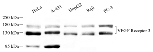 Western blot analysis of VEGF Receptor 3 at dilution of 1: 1000