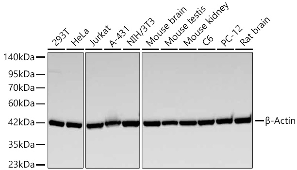Western blot analysis of lysates from HeLa cells, using β-Actin Mouse mAb (AC004) at 1:2000- 1:640000 dilution.
Secondary antibody: HRP-conjugated Goat anti-Mouse IgG (H+L) (AS003) at 1:10000 dilution.
Lysates/proteins: 25μg per lane.
Blocking buffer: 3% nonfat dry milk in TBST.
Detection: ECL Basic Kit (RM00020).
Exposure time: 10s.