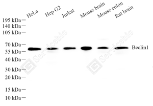 WB analysis of Beclin 1. Sample: Protein treated by RIPA Lysis Buffer . Blocking buffer: 3% Nonfat dry milk in TBST, RT, 1h. Primary antibody: 1: 1000, 4℃ overnight. Secondary antibody: HRP conjugated Goat Anti-Rabbit lgG , 1: 3000, RT, 1h.