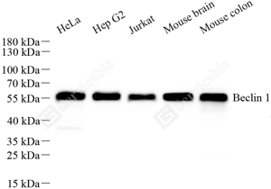 WB analysis of Beclin 1. Sample: Protein treated by RIPA Lysis Buffer . Blocking buffer: 3% Nonfat dry milk in TBST, RT, 1h. Primary antibody: 1: 500, 4℃ overnight. Secondary antibody: HRP conjugated Goat Anti-Mouse lgG , 1: 3000, RT, 1h.