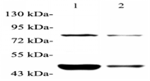 Western blot analysis of LAMP1 at dilution of 1: 1000 Lane 1: MCF7 cell lysate Lane 2: HepG2 cell lysate
