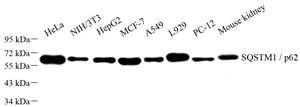 Western blot analysis of SQSTM1 p62 at dilution of 1: 500