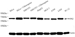 Western blot analysis of P62 at dilution of 1: 500
Lane 1: HeLa cell lysate
Lane 2: HeLa cell lysate
Lane 3: NIH3T3 cell lysate
Lane 4: NIH3T3 cell lysate
Lane 5: HepG2 cell lysate
Lane 6: MCF7 cell lysate
Lane 7: A549 cell lysate
Lane 8: L929 cell lysate
Lane 9: PC-12 cell lysate