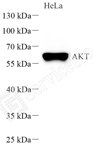 WB analysis of AKT . Sample: Protein treated by RIPA Lysis Buffer . Blocking buffer: 3% Nonfat dry milk in TBST, RT, 1h. Primary antibody: 1:1000, 4℃ overnight. Secondary antibody: HRP conjugated Goat Anti-Rabbit lgG , 1: 3000, RT, 1h.