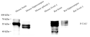 WB analysis of P-TAU . Sample: Protein treated by RIPA Lysis Buffer . Blocking buffer: 3% Nonfat dry milk in TBST, RT, 1h. Primary antibody: 1: 1000, 4℃ overnight. Secondary antibody: HRP conjugated Goat Anti-Rabbit lgG , 1: 3000, RT, 1h.