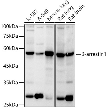 Western blot analysis of various lysates using β-arrestin1 Rabbit pAb  at 1:1000 dilution.
Secondary antibody: HRP-conjugated Goat anti-Rabbit IgG (H+L)  at 1:10000 dilution.
Lysates/proteins: 25μg per lane.
Blocking buffer: 3% nonfat dry milk in TBST.
Detection: ECL West Pico Plus.   
Exposure time: 30s.