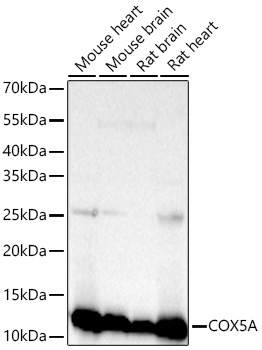 Western blot analysis of lysates from wild type (WT) and COX5A knockdown (KD) HeLa cells using [KD Validated] COX5A Rabbit mAb (A25751) at 1:2000 dilution incubated overnight at 4℃.
Secondary antibody: HRP-conjugated Goat anti-Rabbit IgG (H+L) (AS014) at 1:10000 dilution.
Lysates/proteins: 25 μg per lane.
Blocking buffer: 3% nonfat dry milk in TBST.
Detection: ECL Basic Kit (RM00020)
Exposure time: 30 s.