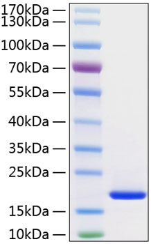 Recombinant Human FGF-1/aFGF Protein was determined by SDS-PAGE under reducing conditions with Coomassie Blue.