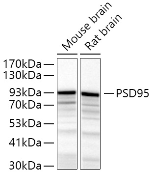 Western blot analysis of various lysates using PSD95 Rabbit pAb at 1:500 dilution.
Secondary antibody: HRP-conjugated Goat anti-Rabbit IgG (H+L) at 1:10000 dilution.
Lysates/proteins: 25μg per lane.
Blocking buffer: 3% nonfat dry milk in TBST.
Detection: ECLWest Pico Plus.
Exposure time: 180s.