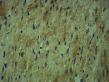 Immunohistochemical analysis of paraffin-embedded Mouse Heart Tissue using β-tubulin Rabbit pAb diluted at 1:500