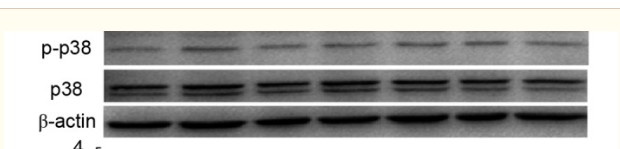 Xu, Yini, et al. "Inhibitory effects of oxymatrine on TGF‑β1‑induced
proliferation and abnormal differentiation in rat cardiac fibroblasts via thep38MAPK and ERK1/2 signaling pathways." Molecular medicine reports 16.4(2017): 5354-5362.
