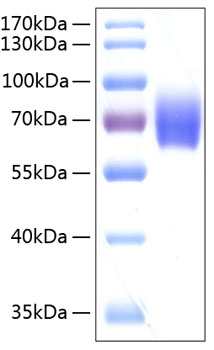 Recombinant human SERPINF2 inhibits trypsin cleavage of a fluorogenic peptide substrate, Mca-RPKPVE-Nval-WRK(Dnp)-NH2. The IC50 value is <0.23nM.
