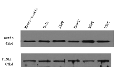 Western Blot analysis of various cell lysis. Primary Antibody was diluted at 1:1000. Secondary antibody was diluted at 1:10000