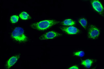 Immunofluorescence analysis of Hela cell. 1,p21 Polyclonal Antibody(green) was diluted at 1:200(4° overnight). 2, Goat Anti Rabbit Alexa Fluor 488 was diluted at 1:1000(room temperature, 50min).
3 DAPI(blue) 10min.