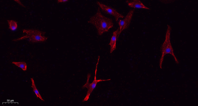 Immunofluorescence analysis of A549. 1,primary Antibody(red) was diluted at 1:200(4°C overnight). 2, Goat Anti Rabbit IgG (H&L) - Alexa Fluor 594 Secondary antibody was diluted at 1:1000(room temperature, 50min).3, Picture B: DAPI(blue) 10min.