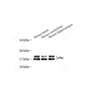 WB analysis of Myelin Basic Protein.Sample: Protein treated by RIPA Lysis Buffer .Blocking buffer: 3% Nonfat dry milk in TBST, RT, 1h.Primary antibody: 1: 1000, 4℃ overnight.Secondary antibody: HRP conjugated Goat Anti-Rabbit lgG , 1: 5000, RT, 1h.
