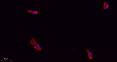 Immunofluorescence analysis of A549. 1,primary Antibody(red) was diluted at 1:200(4°C overnight). 2, Goat Anti Rabbit IgG (H&L) - Alexa Fluor 594 Secondary antibody was diluted at 1:1000(room temperature, 50min).3, Picture B: DAPI(blue) 10min.