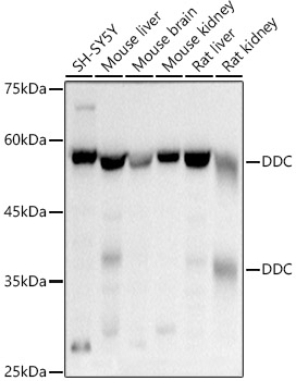 Western blot analysis of various lysates using DDC Rabbit pAb at 1:500 dilution.
Secondary antibody: HRP-conjugated Goat anti-Rabbit IgG (H+L) at 1:10000 dilution.
Lysates/proteins: 25μg per lane.
Blocking buffer: 3% nonfat dry milk in TBST.
Detection: ECL West Pico Plus.
Exposure time: 3s.