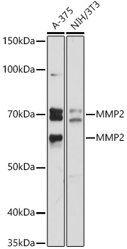 Western blot analysis of various lysates, using MMP2 Rabbit pAb at 1:1000 dilution.
Secondary antibody: HRP-conjugated Goat anti-Rabbit IgG (H+L) at 1:10000 dilution.
Lysates/proteins: 25μg per lane.
Blocking buffer: 3% nonfat dry milk in TBST.
Detection: ECL West Pico Plus.
Exposure time: 90s.