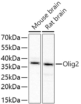 Western blot analysis of lysates from Rat brain using Olig2 Rabbit mAb (MAB26746) at 1:2000 dilution incubated overnight at 4℃.
Secondary antibody: HRP-conjugated Goat anti-Rabbit IgG (H+L) at 1:10000 dilution.
Lysates/proteins: 25 μg per lane.
Blocking buffer: 3% nonfat dry milk in TBST.
Detection: ECL Basic Kit.
Exposure time: 45s.