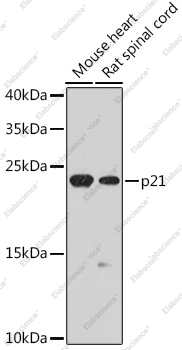 Western blot analysis of extracts of various cell lines using p21 Polyclonal Antibody at dilution of 1:1000.