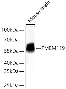 Western blot analysis of lysates from Mouse brain using TMEM119 Rabbit mAb
 at 1:12000 dilution incubated overnight at 4℃.
Secondary antibody: HRP-conjugated Goat anti-Rabbit IgG (H+L)  at 1:10000
dilution.
Lysates/proteins: 25 μg per lane.
Blocking buffer: 3% nonfat dry milk in TBST.
Detection: ECL West Pico Plus.
Exposure time: 45s.