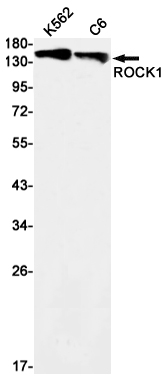Western blot analysis of ROCK1 in K562, C6 lysates using ROCK1 antibody.