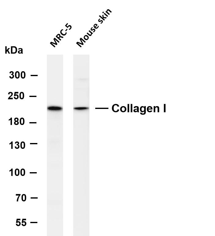 Various whole cell lysates were separated by 4-8% SDS-PAGE, and the membrane was blotted with anti-Collagen I antibody. The HRP-conjugated Goat anti-Rabbit IgG(H+L) antibody was used to detect the antibody. Lane 1: MRC-5, Lane 2: Mouse skin. Predicted band size: 139 kDa, Observed band size: 220 kDa