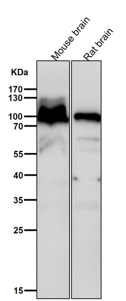 All lanes use the Antibody at 1:2K dilution for 1 hour at room temperature.