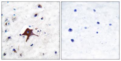 Immunohistochemistry analysis of paraffin-embedded human brain tissue, using GLUT3 Antibody. The picture on the right is blocked with the synthesized peptide.