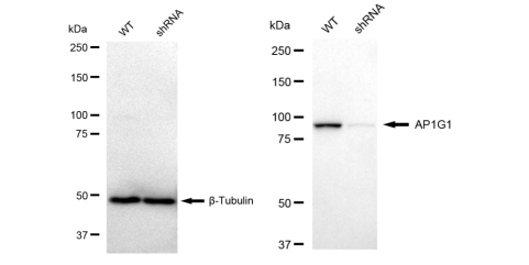 Western blotting analysis using AP1G1 antibody (KVAb01388). AP1G1 expression in wild type (WT) and AP1G1 shRNA knockdown (KD) HeLa cells with 30 μg of total cell lysates. Hsp90 α serves as a loading control. The blot was incubated with AP1G1 antibody (KVAb01388, 1:5,000) and HRP-conjugated goat anti-rabbit secondary antibody (APS0635, 1:10,000) respectively.