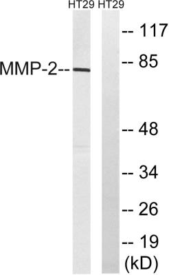 Western blot analysis of lysates from HT-29 cells, using MMP-2 Antibody. The lane on the right is blocked with the synthesized peptide.