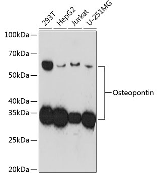 Western blot analysis of various lysates using Osteopontin Rabbit mAb at 1:1000 dilution incubated overnight at 4℃.
Secondary antibody: HRP-conjugated Goat anti-Rabbit IgG (H+L) at 1:10000 dilution.
Lysates/proteins: 25μg per lane.
Blocking buffer: 3% nonfat dry milk in TBST.
Detection: ECL West Pico Plus.
Exposure time: 3min.
