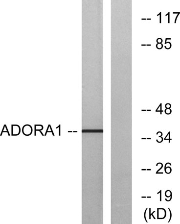 Western blot analysis of lysates from MCF-7 cells, using ADORA1 Antibody. The lane on the right is blocked with the synthesized peptide.
