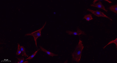 Immunofluorescence analysis of A549. 1,primary Antibody(red) was diluted at 1:200(4°C overnight). 2, Goat Anti Rabbit IgG (H&L) - Alexa Fluor 594 Secondary antibody was diluted at 1:1000(room temperature, 50min).3, Picture B: DAPI(blue) 10min.