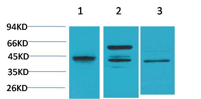 Western blot analysis of 1) Hela, 2)Raw 264.7, 3)PC12 with Caspase 8 Rabbit pAb EA225 diluted at 1:2,000.