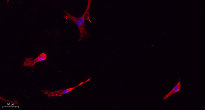 Immunofluorescence analysis of A549. 1,primary Antibody(red) was diluted at 1:200(4°C overnight). 2, Goat Anti Rabbit IgG (H&L) - Alexa Fluor 594 Secondary antibody was diluted at 1:1000(room temperature, 50min).3, Picture B: DAPI(blue) 10min.