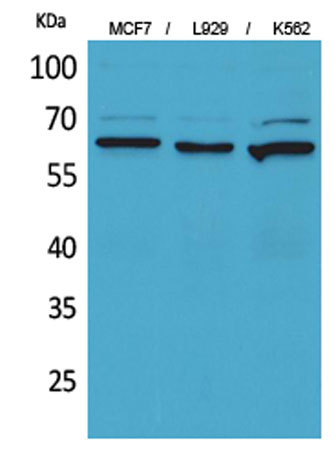 Western Blot analysis of MCF7, L929, K562 cells using CD73 Polyclonal Antibody. Secondary antibody(catalog#:RS0002) was diluted at 1:20000