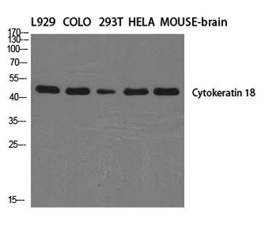 Western Blot analysis of various cells using Cytokeratin 18 Polyclonal Antibody diluted at 1:2000