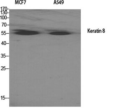 Western Blot analysis of various cells using Cytokeratin 8 Polyclonal Antibody diluted at 1:2000