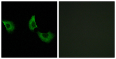 Immunofluorescence analysis of A549 cells, using EFEMP2 Antibody. The picture on the right is blocked with the synthesized peptide.