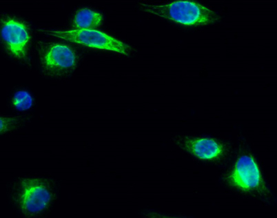 Immunofluorescence analysis of Hela cell. 1,IL-8 Polyclonal Antibody(green) was diluted at 1:200(4° overnight). 2, Goat Anti Rabbit Alexa Fluor 488 was diluted at 1:1000(room temperature, 50min). 3 DAPI(blue) 10min.