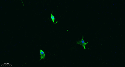 Immunofluorescence analysis of A549. 1,primary Antibody was diluted at 1:200(4°C overnight). 2, Goat Anti Rabbit IgG (H&L) - Alexa Fluor 488 Secondary antibody was diluted at 1:1000(room temperature, 50min).3, Picture B: DAPI(blue) 10min.