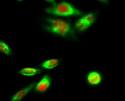 Immunofluorescence analysis of Hela cell. 1,PPAR-α Polyclonal Antibody(red) was diluted at 1:200(4° overnight). Galectin-3 Monoclonal Antibody(6G2)(green) was diluted at 1:200(4° overnight). 2, Goat Anti Rabbit Alexa Fluor 594 Catalog:RS3611 was diluted a