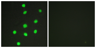 Immunofluorescence analysis of HepG2 cells, using GLI-3 Antibody. The picture on the right is blocked with the synthesized peptide.